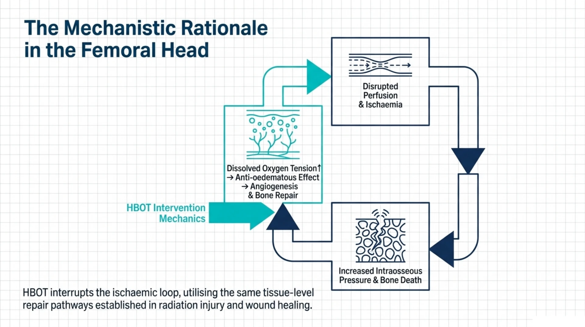 Flow diagram showing how hyperbaric oxygen therapy raises tissue oxygen, reduces oedema, and supports angiogenesis and bone repair to interrupt the ischaemic cycle in femoral head osteonecrosis