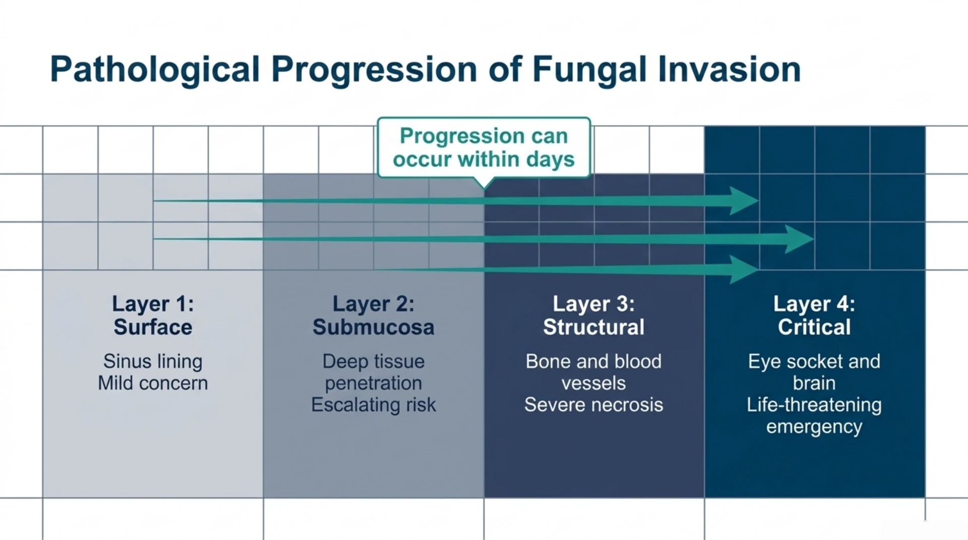 Diagram showing invasive fungal rhinosinusitis progressing from the sinus surface through submucosal tissue to bone, blood vessels, and the eye socket or brain.