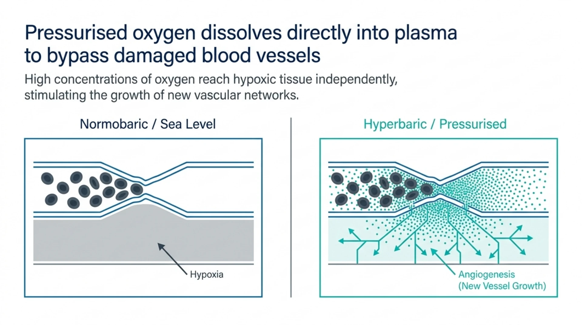 Diagram comparing normobaric and hyperbaric oxygen at the capillary level, showing how pressurised oxygen dissolved in plasma can reach hypoxic tissue independently of damaged vessels and support new vessel growth.