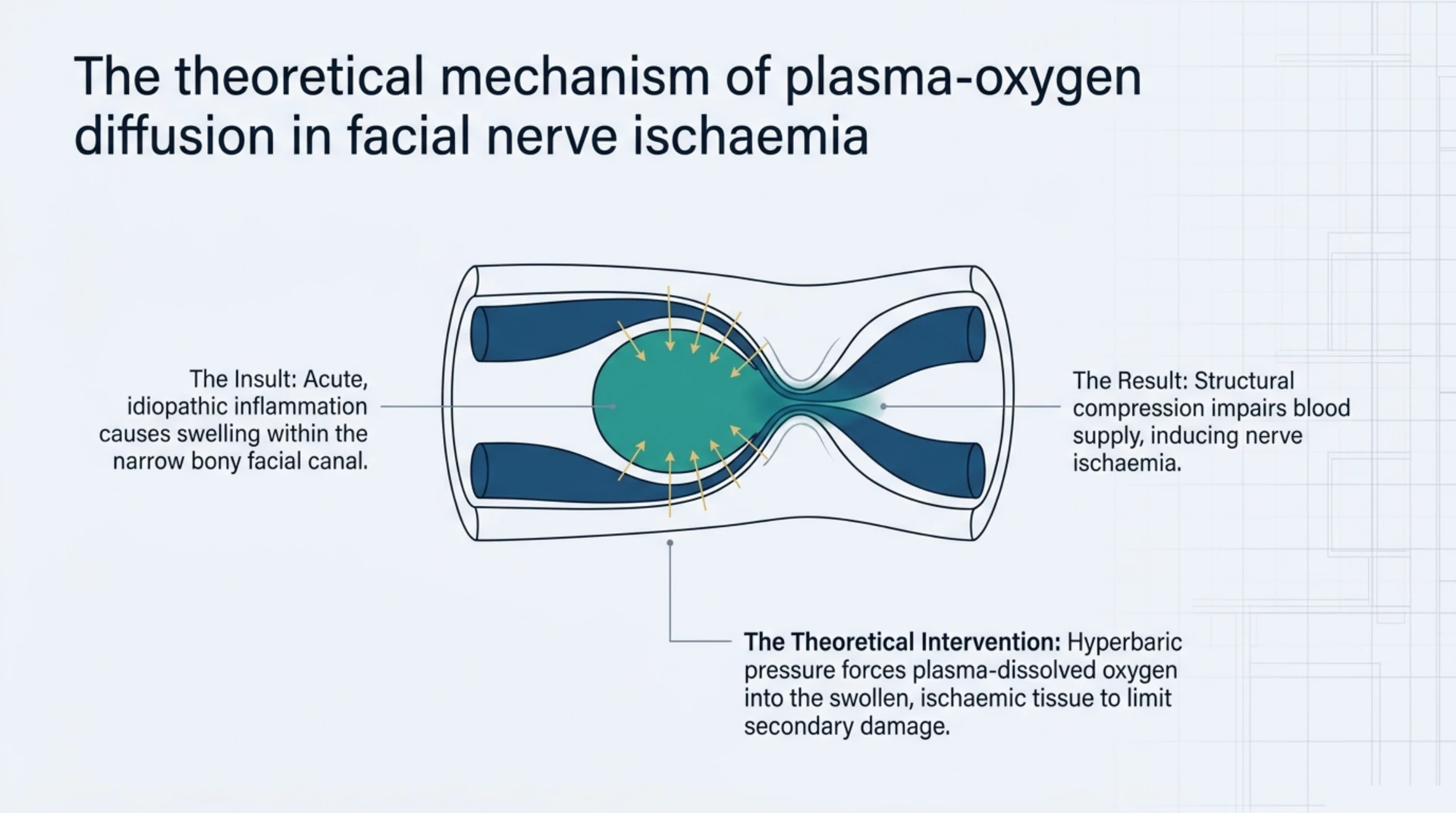 Diagram of the theoretical mechanism by which hyperbaric oxygen may support ischaemic facial nerve tissue in Bell's palsy