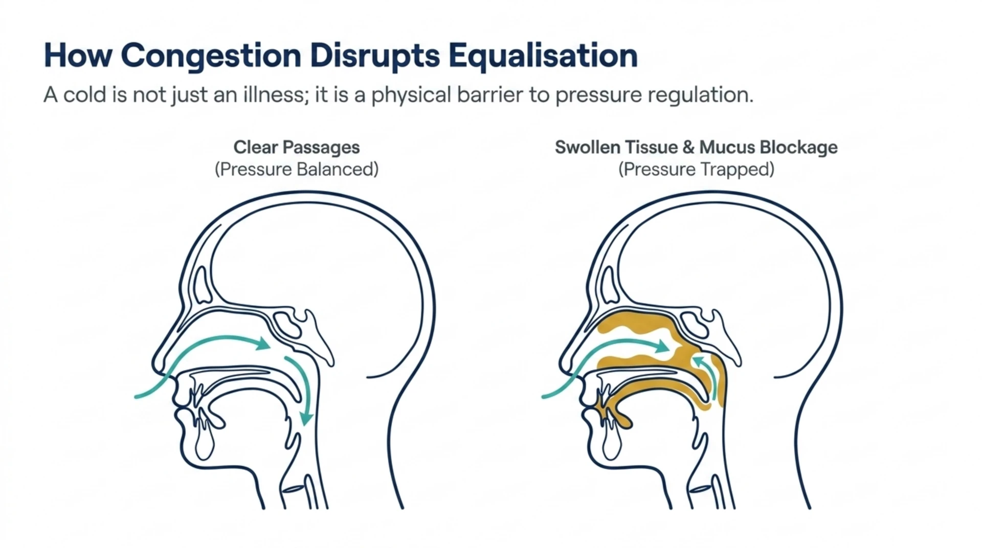 Side-by-side comparison of clear nasal passages versus swollen, congested passages that trap pressure during a hyperbaric session.